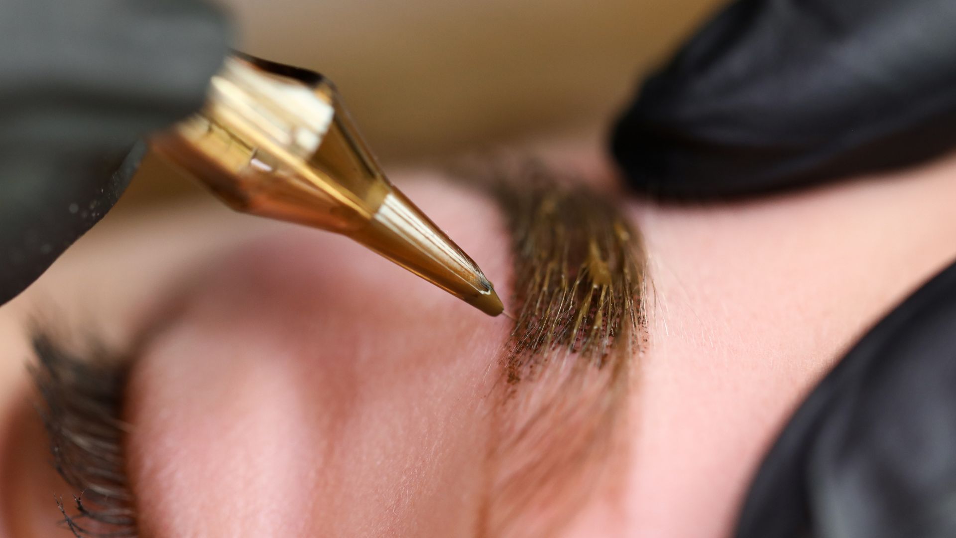 Micropigmentation