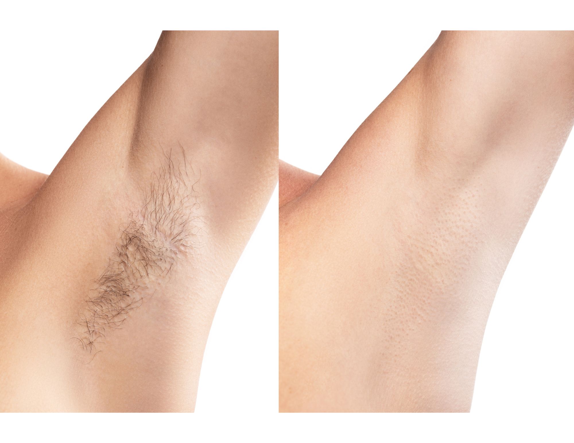 Underarm Wax