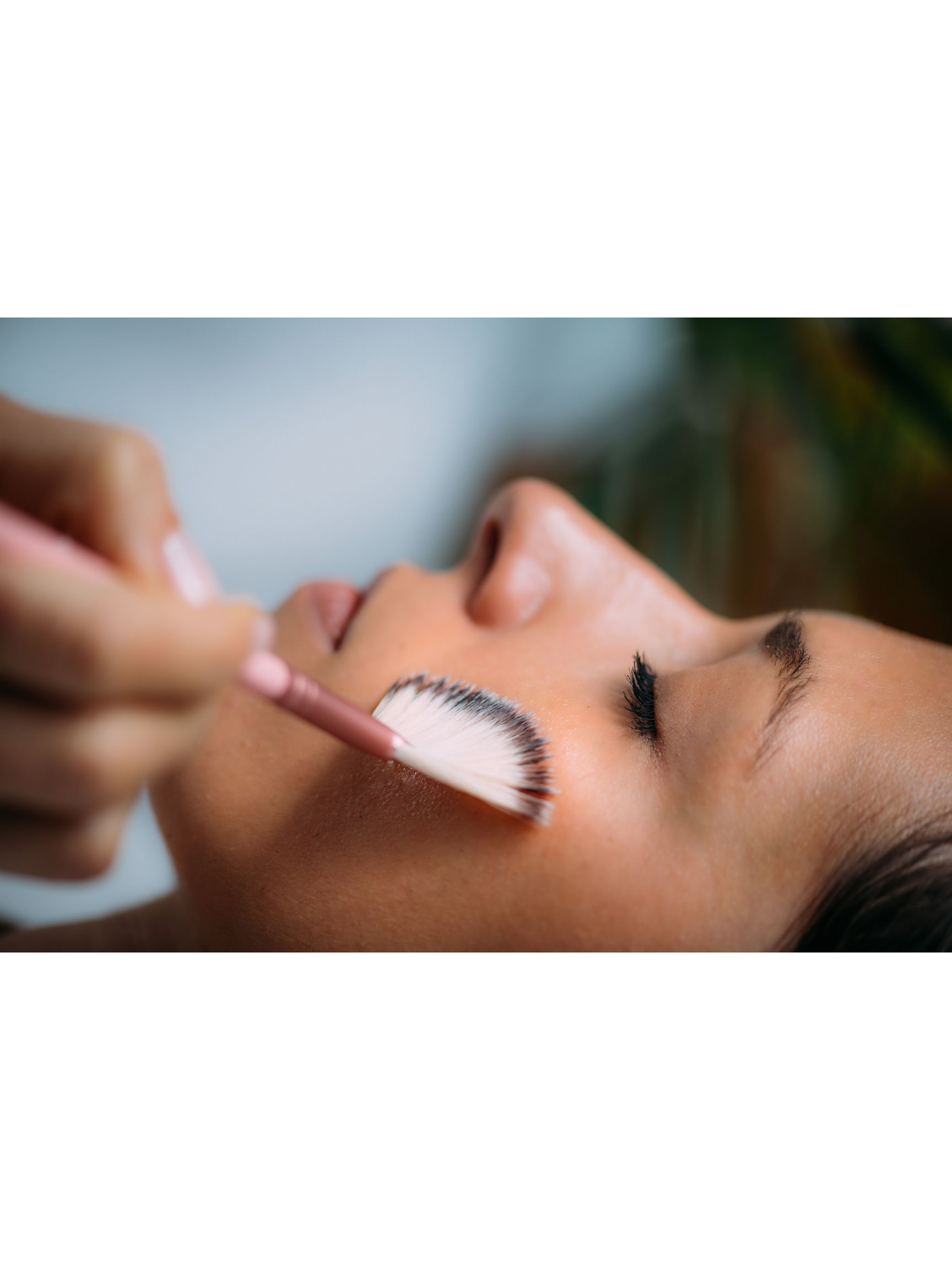 Lactic Acid Peel