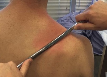 Gua Sha